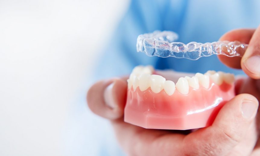 Invisible and removable aligners for teeth alignment